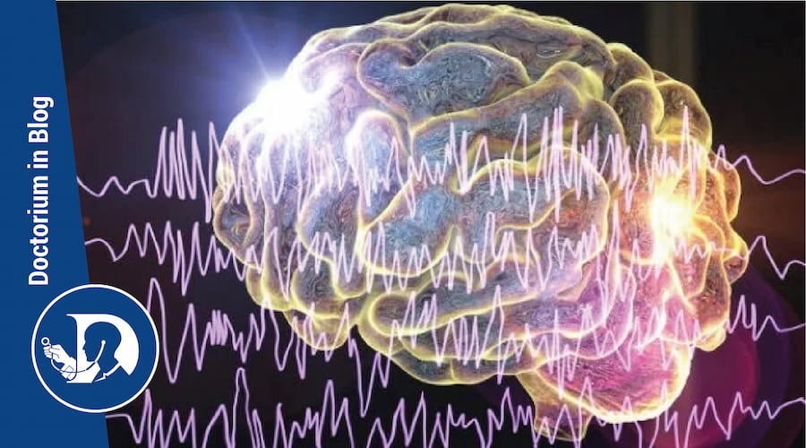 Come riconoscere i sintomi dell'epilessia