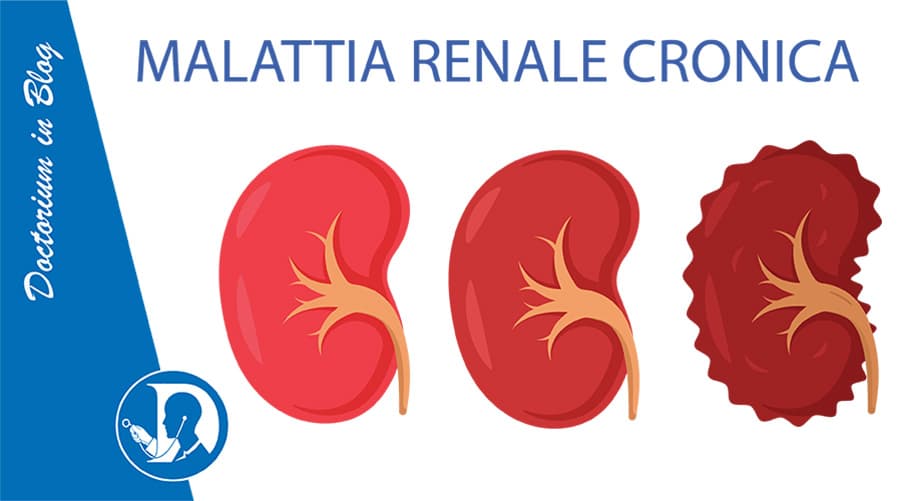 Malattia Renale Cronica