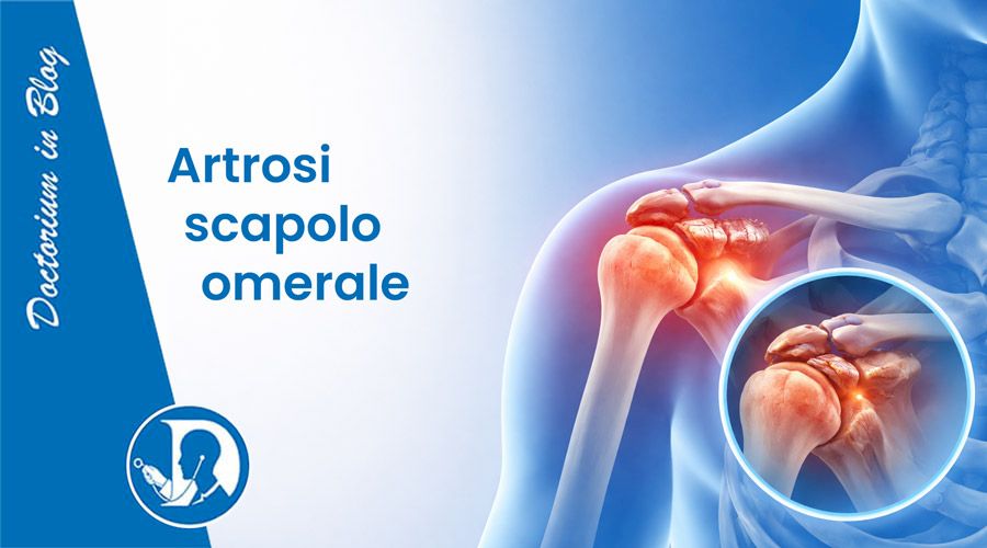 Artrosi alla spalla: sintomi, cause e trattamenti efficaci